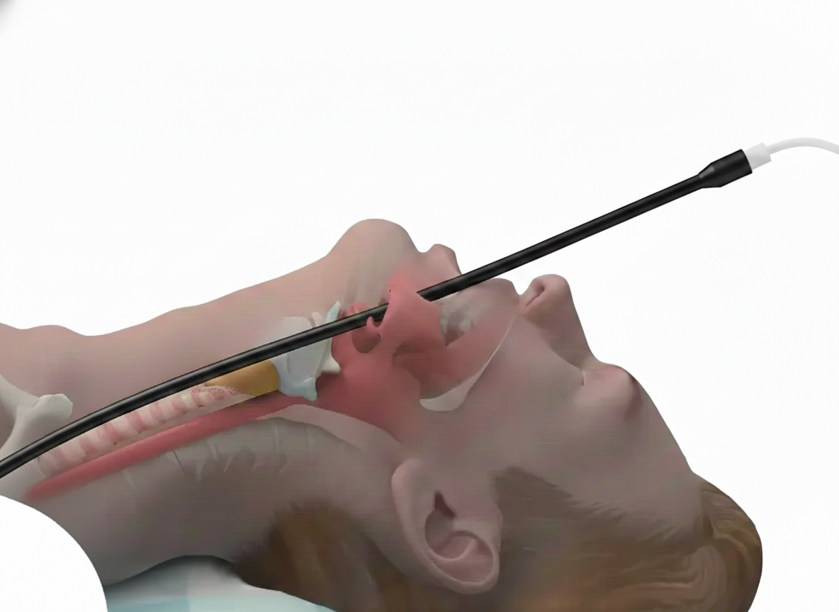 Thyroid Surgery