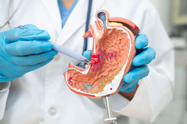 Digestive Surgery